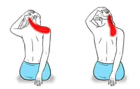 Tập gì để hết đau vai gáy